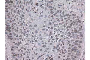 Immunohistochemical staining of paraffin-embedded colon using anti-STAT3 (ABIN2452542) mouse monoclonal antibody. (STAT3 anticorps  (AA 154-175))