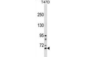 Western Blotting (WB) image for anti-Rhophilin, rho GTPase Binding Protein 2 (RHPN2) antibody (ABIN3000839)