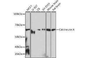 Western blot analysis of extracts of various cell lines, using Calcineurin A Rabbit mAb (ABIN7269692) at 1:1000 dilution. (PPP3CA anticorps)