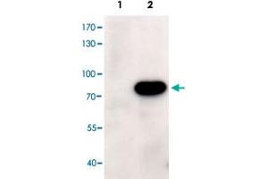 HEK293 overexpressing human ABCD1 and probed with ABCD1 polyclonal antibody  at 1ug/ml (mock transfection in first lane). (ABCD1 anticorps)