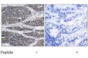 Image no. 1 for anti-Nuclear Factor of kappa Light Polypeptide Gene Enhancer in B-Cells 1 (NFKB1) (Ser932) antibody (ABIN197494)
