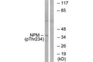 Western blot analysis of extracts from HeLa cells treated with nocodazole 1ug/ml 18h, using NPM (Phospho-Thr234) Antibody. (NPM1 anticorps  (pThr234))
