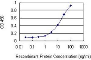 Detection limit for recombinant GST tagged BAZ1B is 0.