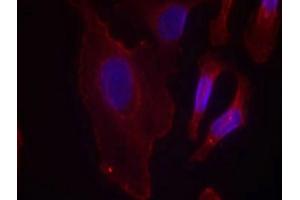 Immunofluorescence staining of methanol-fixed Hela cells using PLCg2(Phospho-Tyr753) Antibody. (Phospholipase C gamma 2 anticorps  (pTyr753))