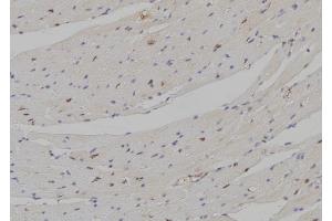 ABIN6274297 at 1/100 staining Mouse heart tissue by IHC-P.