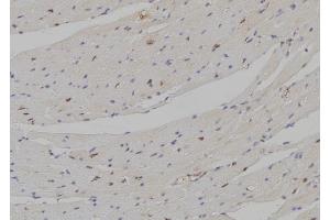 ABIN6274297 at 1/100 staining Mouse heart tissue by IHC-P. (DLX5 anticorps  (Internal Region))