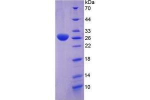 SDS-PAGE of Protein Standard from the Kit (Highly purified E. (Clusterin Kit ELISA)