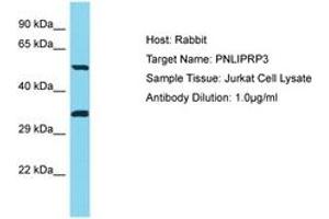 Image no. 1 for anti-Pancreatic Lipase-Related Protein 3 (PNLIPRP3) (AA 389-438) antibody (ABIN6750748)