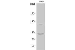 Western Blotting (WB) image for anti-PR (pSer190) antibody (ABIN3172967) (PR (pSer190) anticorps)