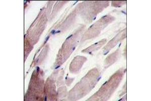 Formalin-fixed and paraffin-embedded human skeletal muscle tissue reacted with the P38 gamma antibody (C-term), which was peroxidase-conjugated to the secondary antibody, followed by DAB staining. (MAPK12 anticorps  (C-Term))