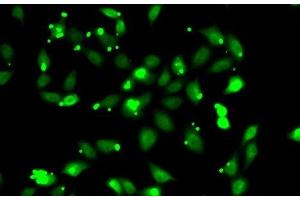 Immunofluorescence analysis of HeLa cells using C1S Polyclonal Antibody (C1S anticorps)