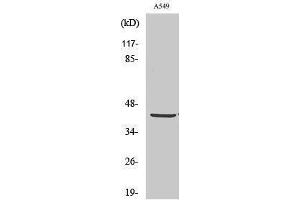 Western Blotting (WB) image for anti-Pyruvate Dehydrogenase (Lipoamide) alpha 1 (PDHA1) (C-Term) antibody (ABIN3186372) (PDHA1 anticorps  (C-Term))