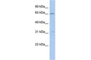 anti-Mitochondrial Calcium Uptake Family, Member 3 (MICU3) (AA 71-120) antibody