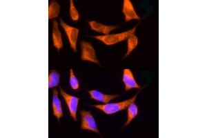Immunofluorescence analysis of HeLa cells using ROCK2 Rabbit pAb (ABIN6129455, ABIN6147068, ABIN6147069 and ABIN6221359) at dilution of 1:150 (40x lens). (ROCK2 anticorps  (AA 1109-1388))