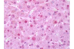 Human Liver: Formalin-Fixed, Paraffin-Embedded (FFPE)