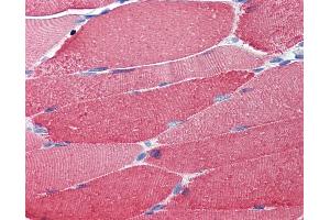 Anti-MYL2 antibody IHC of human skeletal muscle.