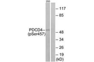 Western blot analysis of extracts from 293 cells treated with serum 20% 15', using PDCD4 (Phospho-Ser457) Antibody. (PDCD4 anticorps  (pSer457))