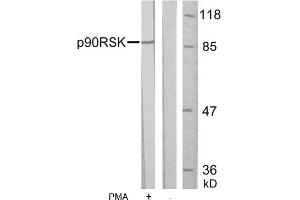 Image no. 1 for anti-Ribosomal Protein S6 Kinase, 90kDa, Polypeptide 1 (RPS6KA1) (Ser352) antibody (ABIN197331)