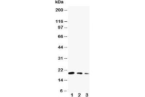 Western blot testing of CDC42 antibody and Lane 1:  ecombinant human protein 10ng;  2: 5ng;  3: 2. (CDC42 anticorps  (Middle Region))