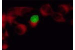 Immunofluorescence (IF) image for anti-Herpes Simplex Virus Type 1 ICP4 (HSV1 ICP4) antibody (ABIN265556) (HSV1 ICP4 anticorps)