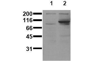 Western Blotting (WB) image for anti-Signal Transducer and Activator of Transcription 6, Interleukin-4 Induced (STAT6) (pTyr641) antibody (ABIN126901) (STAT6 anticorps  (pTyr641))