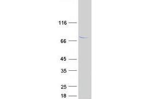 Validation with Western Blot