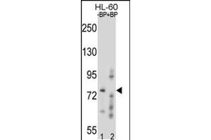 Western blot analysis of RNF40 Antibody Pab pre-incubated without(lane 1) and with(lane 2) blocking peptide in HL-60 cell line lysate.