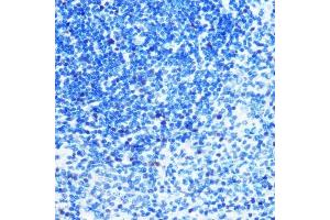 Immunohistochemistry of paraffin-embedded rat spleen using MCM3 Rabbit mAb (ABIN7268540) at dilution of 1:100 (40x lens).