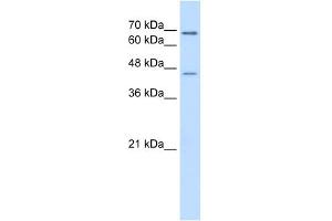 ALDH3A2 antibody used at 0. (ALDH3A2 anticorps  (C-Term))