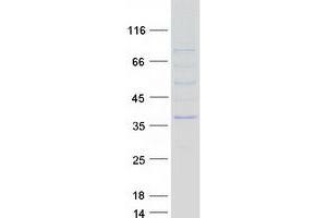 Validation with Western Blot