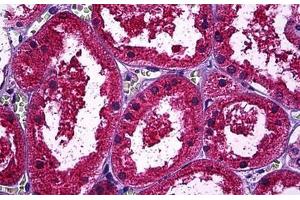 Human Kidney, Tubules: Formalin-Fixed, Paraffin-Embedded (FFPE) (Osteopontin anticorps)