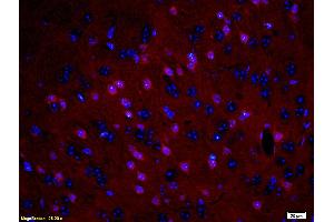 Formalin-fixed and paraffin embedded: rat brain tissue labeled with Anti-MBP Polyclonal Antibody (ABIN739400), Unconjugated at 1:200, followed by conjugation to the secondary antibody was Goat Anti-Rabbit IgG, PE conjugated at 1:200 for 40 minutes at 37°C DAPI(5 µg/ml, blue) was used to stain the cell nuclei (MBP anticorps  (AA 69-85))
