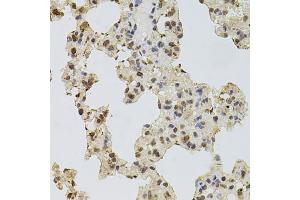 Immunohistochemistry of paraffin-embedded rat lung using EGFR antibody (ABIN5997646) at dilution of 1/100 (40x lens). (EGFR anticorps)