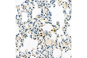 Immunohistochemistry of paraffin embedded rat lung using TMEM176A (ABIN7075995) at dilution of 1:500 (400x lens) (TMEM176A anticorps)