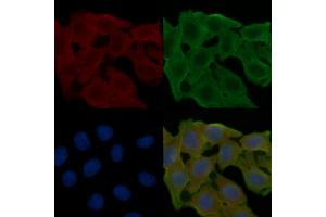 ABIN6258013 and ABIN6274979 staining Hela cells(24h of starvation treatment) by IF/ICC. (CDC42EP2 anticorps  (N-Term))