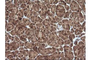 Image no. 1 for anti-Phosphoinositide-3-Kinase, Regulatory Subunit 5 (PIK3R5) antibody (ABIN1500211)