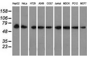Western blot analysis of extracts (35 µg) from 9 different cell lines by using anti-PEX5 monoclonal antibody. (PEX5 anticorps)