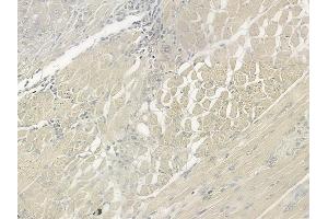 ABIN6266286 and ABIN6277442 at 1/100 staining human tongue carcinoma by IHC-P. (TRIM63 anticorps  (N-Term))