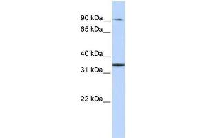 ZFP90 antibody used at 0. (ZNF90 anticorps  (Middle Region))