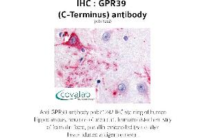 Image no. 1 for anti-G Protein-Coupled Receptor 39 (GPR39) (C-Term) antibody (ABIN1735081) (GPR39 anticorps  (C-Term))
