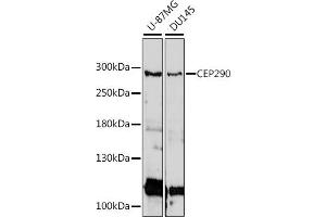 Western blot analysis of extracts of various cell lines, using CEP290 antibody (ABIN7266277) at 1:1000 dilution. (CEP290 anticorps  (AA 950-1050))