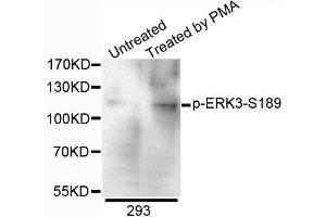 Western blot analysis of extracts of 293 cells, using Phospho-ERK3-S189 antibody. (MAPK6 anticorps  (pSer189))