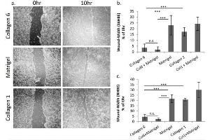 COL6 enhances lung epithelial cell wound repair.