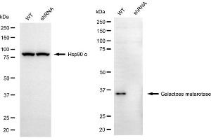 Western blotting analysis using galactose mutarotase antibody (ABIN7798681). (GALM anticorps)