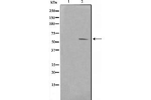 Western blot analysis on HuvEc cell lysate using Pim-1 Antibody，The lane on the left is treated with the antigen-specific peptide. (PIM1 anticorps  (Internal Region))