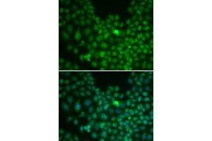Immunofluorescence analysis of U2OS cells using Clusterin alpha chain antibody (ABIN6133478, ABIN6138757, ABIN6138759 and ABIN6217494). (Clusterin anticorps  (AA 220-449))