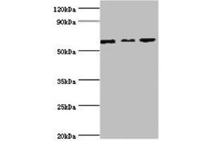 Western blot All lanes: MAPK4 ntibody at 6 μg/mL Lane 1: Mouse brain tissue Lane 2: 293T whole cell lysate Lane 3: Jurkat whole cell lysate Secondary Goat polyclonal to rabbit IgG at 1/10000 dilution Predicted band size: 66 kDa Observed band size: 66 kDa (MAPK4 anticorps  (AA 348-587))