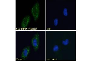 ABIN190858 Immunofluorescence analysis of paraformaldehyde fixed U251 cells, permeabilized with 0. (TMED10 anticorps  (C-Term))