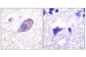 Immunohistochemistry (IHC) image for anti-Potassium Inwardly-Rectifying Channel, Subfamily J, Member 16 (KCNJ16) (Ser416) antibody (ABIN1848056) (KIR5.1 anticorps  (Ser416))