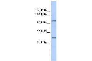 KIAA1618 antibody used at 5 ug/ml to detect target protein.